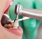 Dental Cleaning