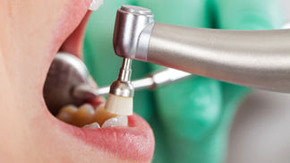 Common Culprits: Foods & Beverages That Cause Teeth Discoloration