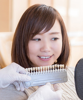歯の色見本を見る女性