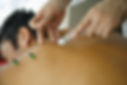 Session d'acupuncture