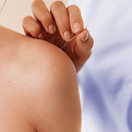Acupuncture on Shoulder