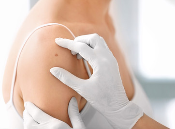Skin Biopsy