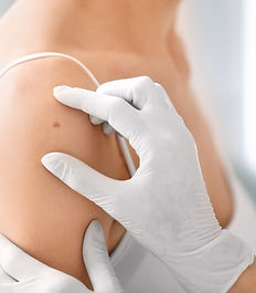 Skin Checkup