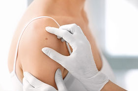 Skin Biopsy