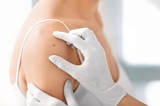 Skin Biopsy