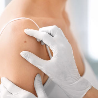 Dual-Task Training May Improve Shoulder Function After Rotator Cuff Repair