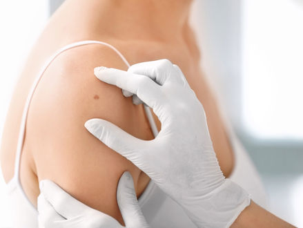 Why Skin Cancer Awareness Could Save Your Life | Brilliant Online Digital PR Australia Singapore UK Europe