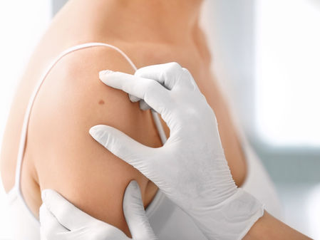 Parkinson's Disease and Skin Problems