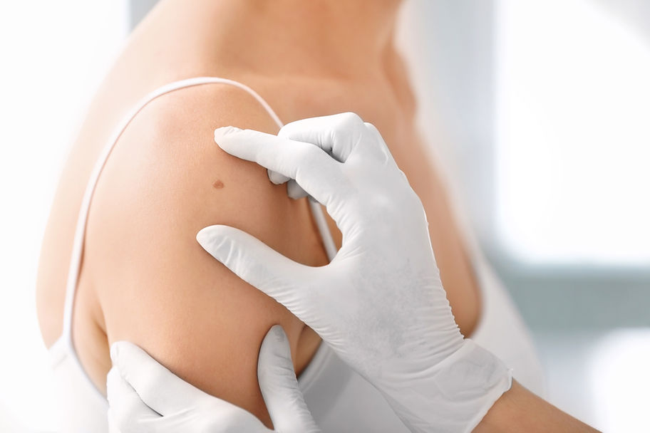 Skin Biopsy