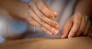 Gros plan sur l'acupuncture