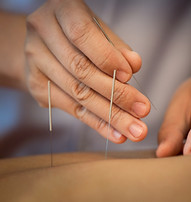 Acupuncture Close Up