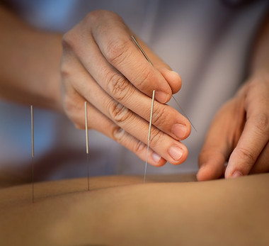 Acupuncture Close Up