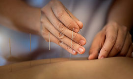 Acupuncture Close Up