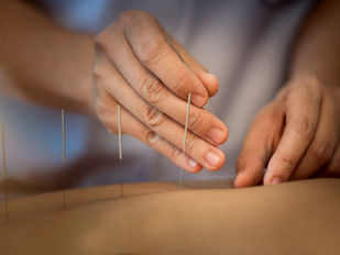 Acupuncture for weight management