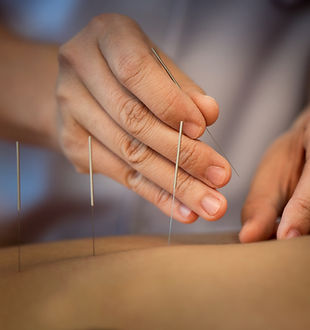 Acupuncture Close Up