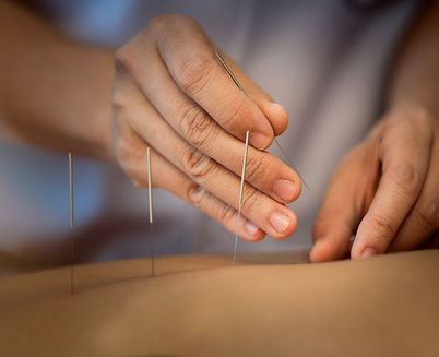 Acupuncture Close Up
