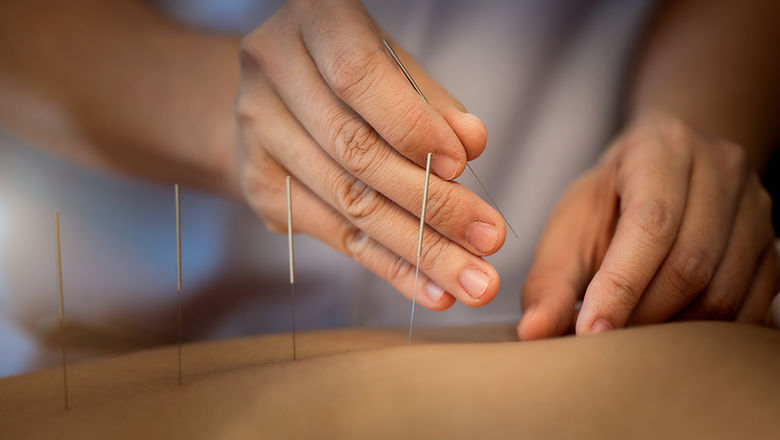 טיפול דיקור סיני לנדודי שינה בראשון לציון { מרפאת אלף לילה