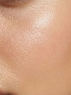 Professional dermaplaning treatment being performed at Clinic4O2 in Takanini, Auckland