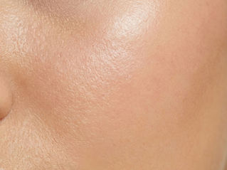 A Facialist's Notes On Pore Size
