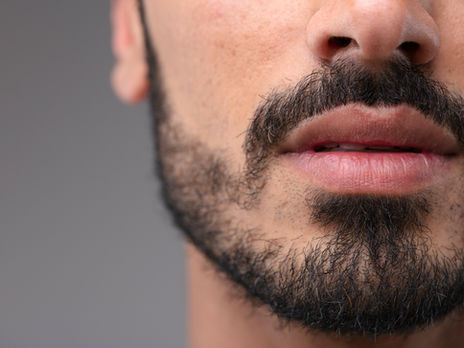 Acne Scarring Treatment Melbourne Preston