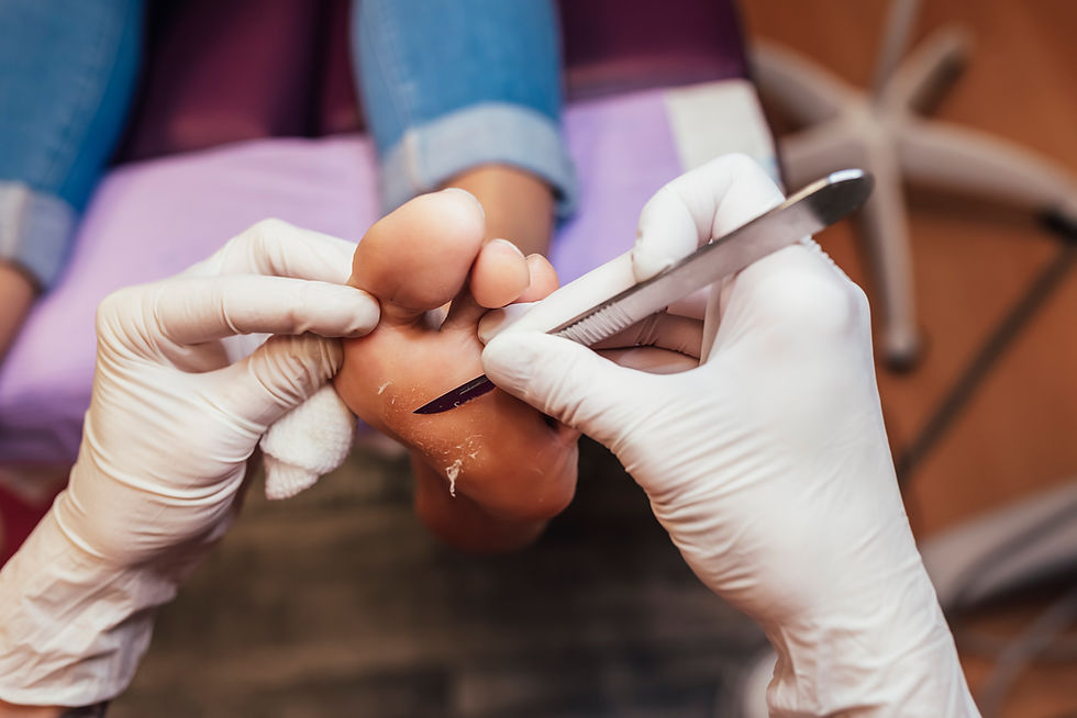 A chiropodist taking care of foot - removing hard skin with special tool