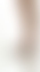 6 Things to Consider When You Want to Lose Weight