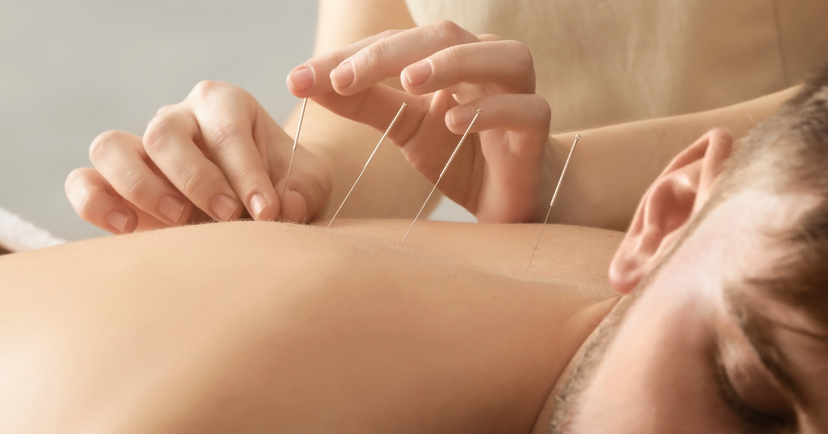 A qualified practitioner performing acupuncture using fine, sterile needles in a calm clinical treatment room.