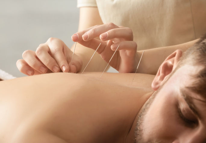   Acupuncture is a method of encouraging the body to promote natural healing and to improve functioning. This is done by inserting hair-thin needles into specific acupuncture points. Practiced for over 2500 years in China, acupuncture is part of Traditional Chinese Medicine (TCM), which views health as a constantly flow of energy. 

  Acupuncture helps to regulate imbalances in this natural flow of energy, which result in disease.

  The acupuncture needles can unblock the obstruction at the dams, and re-establish the regular flow through the meridians. 

  Acupuncture treatment can therefore help the body’s internal organs to correct imbalances in digestion, absorption, energy production activities and the circulation of energy through the meridians.