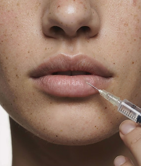 Lip Injection Procedure