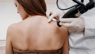 From Brows to Body Art: What You Need to Know About Laser Tattoo Removal in Flagstaff, AZ