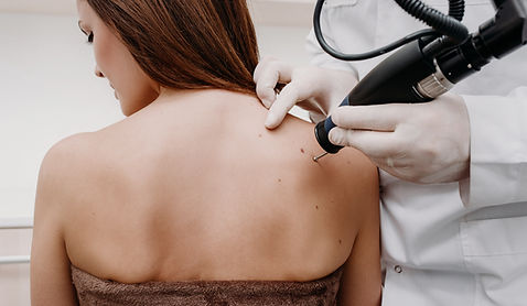 Laser Skin Treatment