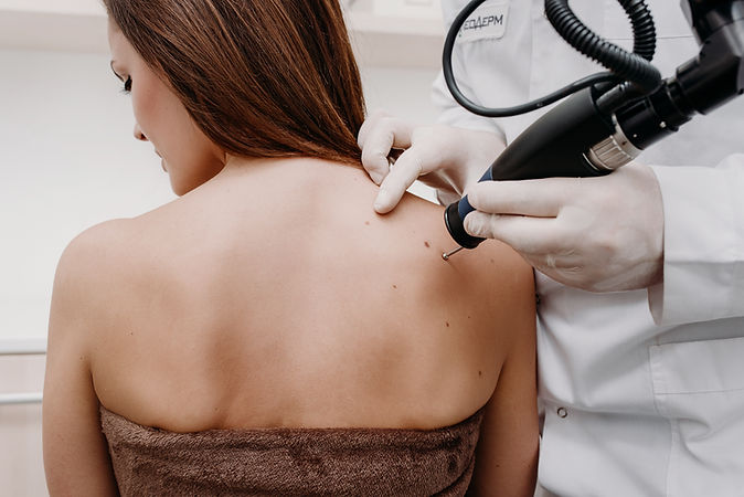 Laser Skin Treatment