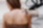 Laser Skin Treatment