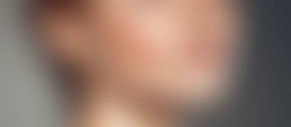 TUMORE AL SENO: PERCHE' L'AUTOPALPAZIONE E' ESSENZIALE