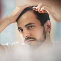 PRP Hair Loss Treatment 