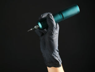 Laser Tattoo Removal