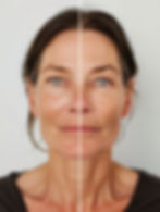 Anti-aging Treatment Comparison
