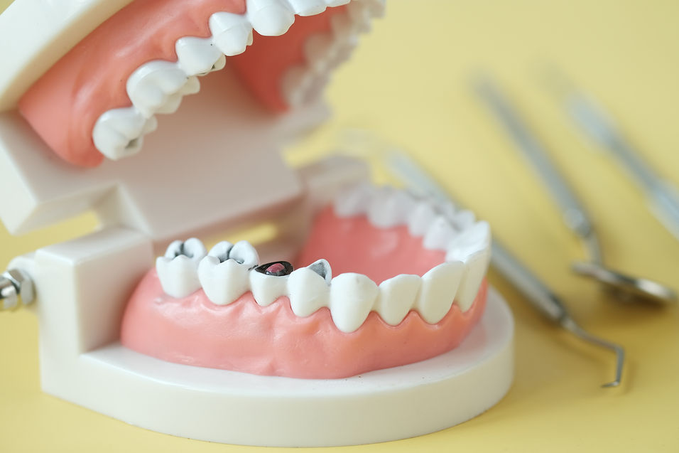 plastic dental teeth model on white background