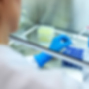 biopsia de médula ósea, punción de médula ósea