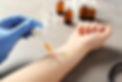 Skin Prick Test