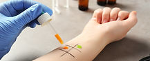  It emphasizes the necessity of standardized diagnostic criteria for MCAS, as most patients fulfilling MCAS criteria also meet the clinical definition of anaphylaxis.