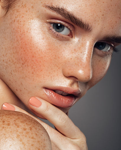 Best laser for dark spots Raleigh NC