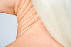 Cuello de mujer mayor