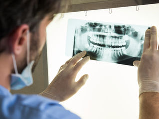 Implante dentário pode rejeitar? Entenda o que realmente acontece