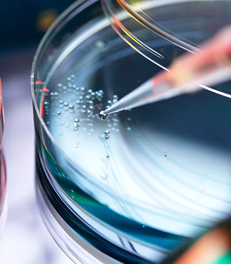 Petri Dish Experiment