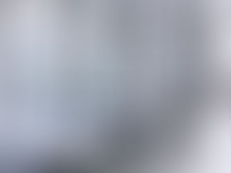 内視鏡検査にともなう不安について
