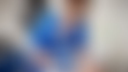 Say Goodbye to Discoloration and Melasma with Advanced Laser Facials