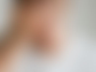 Jaw/Face Pain, Anxiety, & Depression