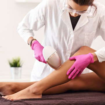 Laser hair removal