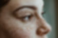 Freckled Face Close-Up